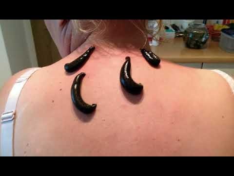 giải mã giấc mơ thấy đỉa